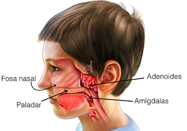 Imagem indicando as adenoides e amígdalas.